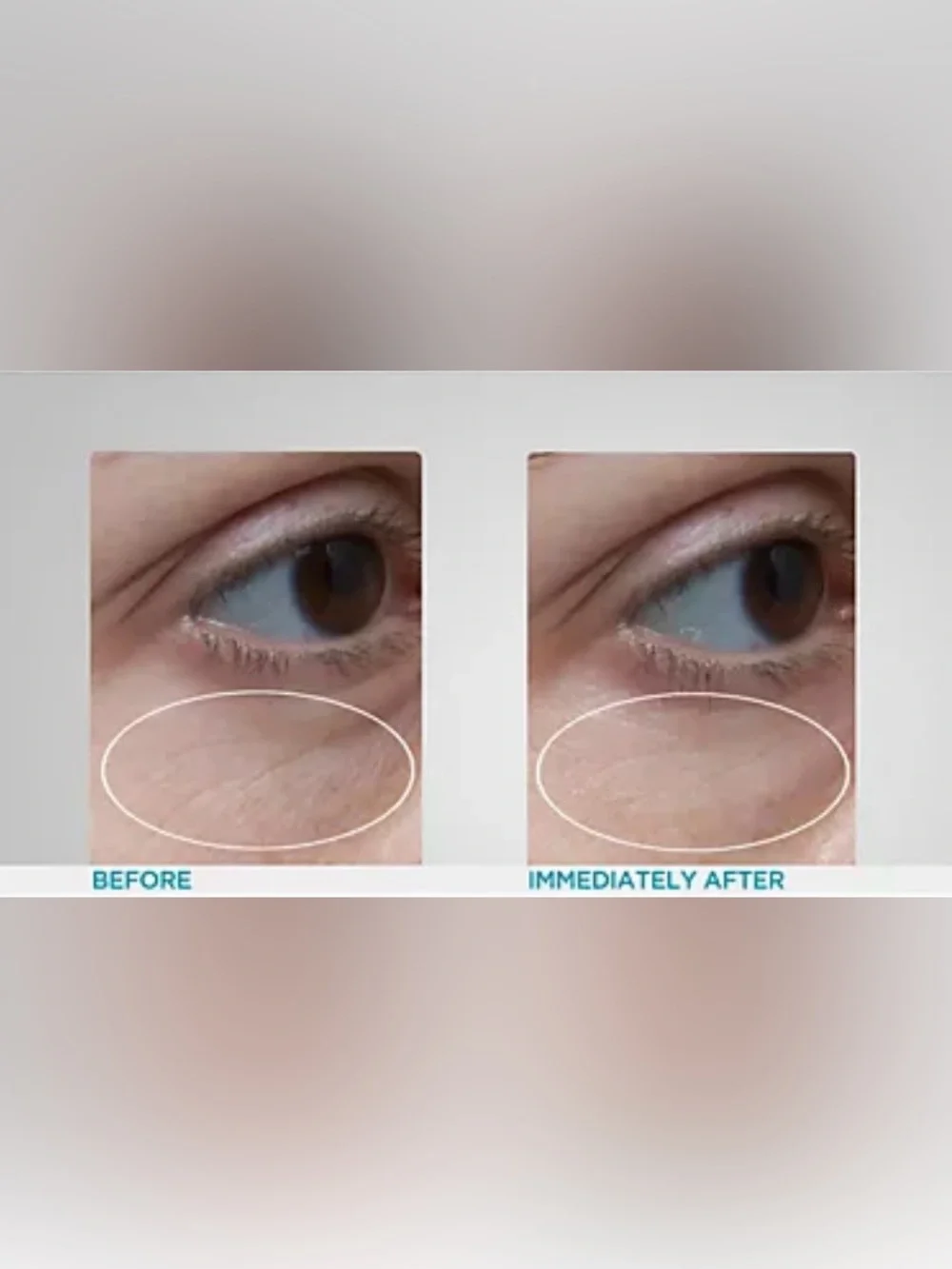 Peter Thomas Roth Gold Hydrating Eye Gel Patches - 30 pair